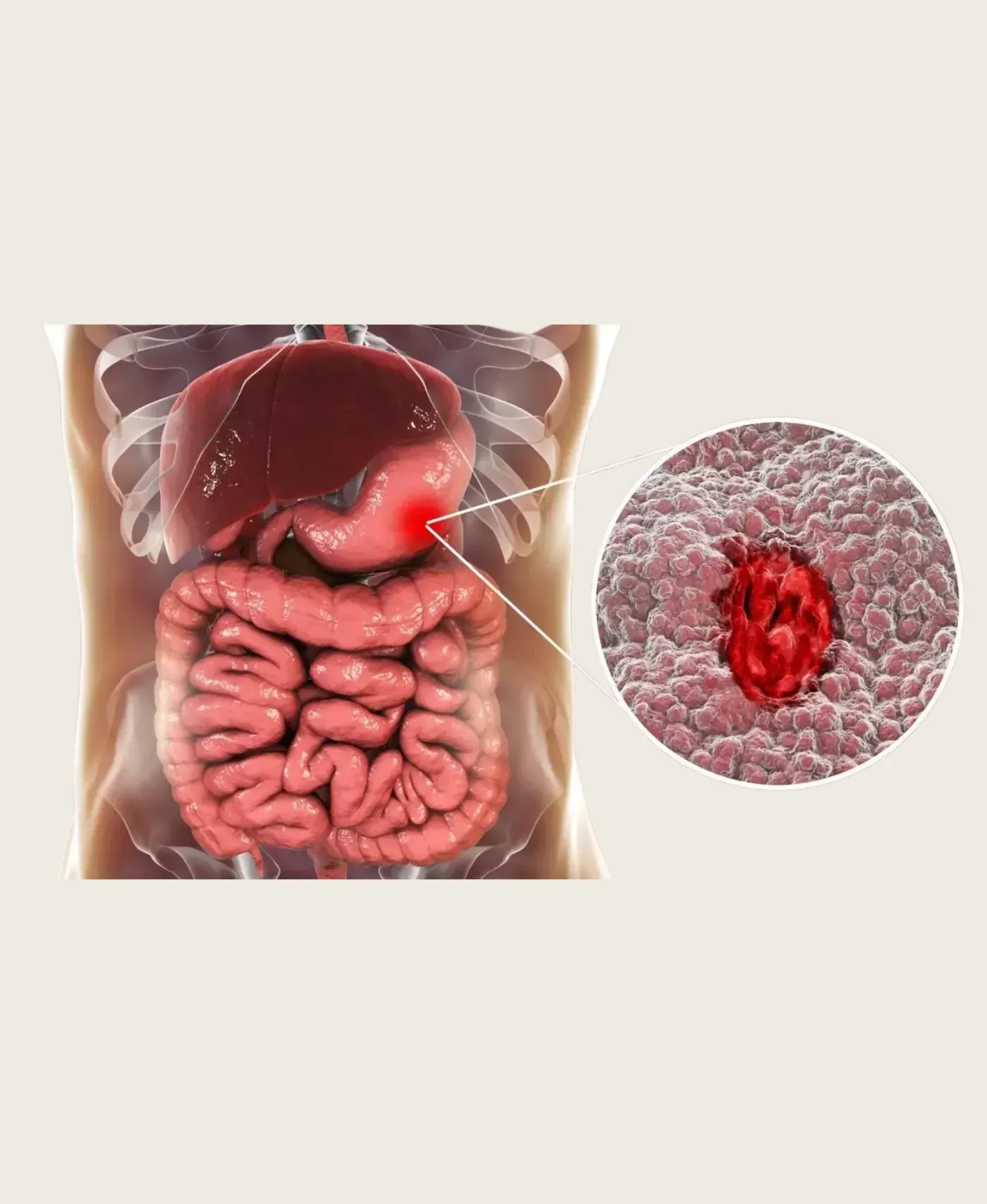 Dr. Neel Patel - GI Cancer Surgery care at Niraaya Hospital Gandhinagar